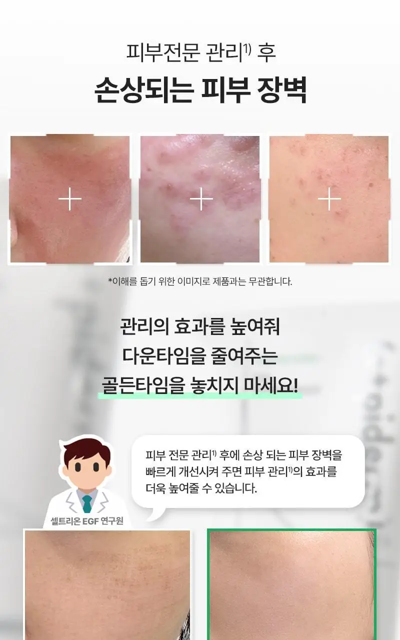 [장벽탄력/트러블] 지피덤 셀트리온EGF 스킨베리어 인텐시브 크림 80ml 기획 (+크림15ml+앰플1ml*3ea) 상세페이지 6